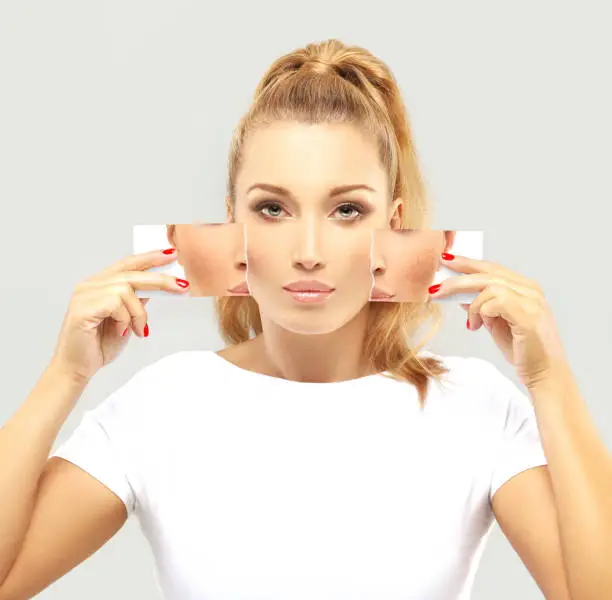 istockphoto-1256674016-612x612-1 Understanding Skinpres T: Benefits, Uses, and Insights (2025)